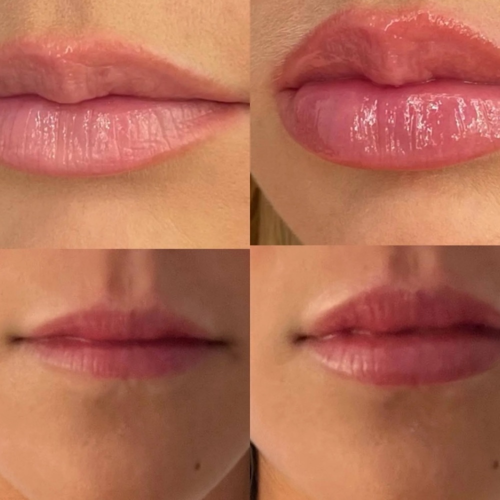 BEAMBO The Lip Gizmo - Picture 4 of 4